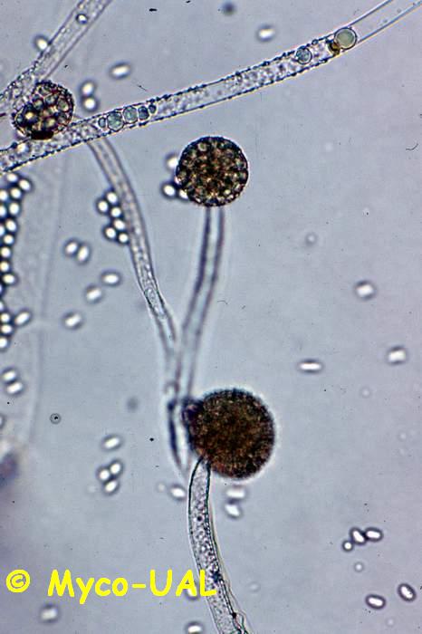 Споры гриба мукора. Мицелий мукора микроскоп. Мицелий мукора под микроскопом. Грибок мукор рацемозус. Ризопус мицелий.