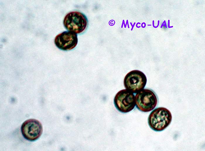 Telisporas de U. cynodontis