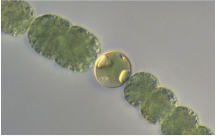 Anabaena