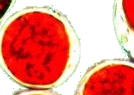 Haematococcus pluvialis